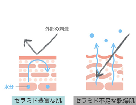 セラミド不足の肌